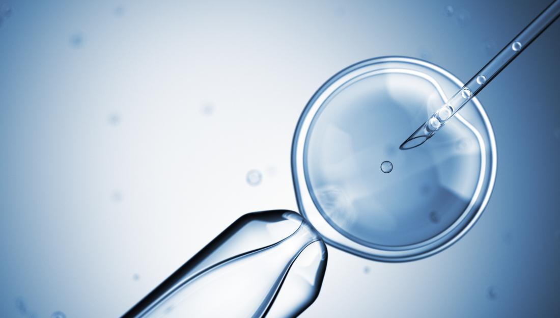 artificial-insemination