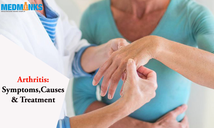 arthritis-treatment