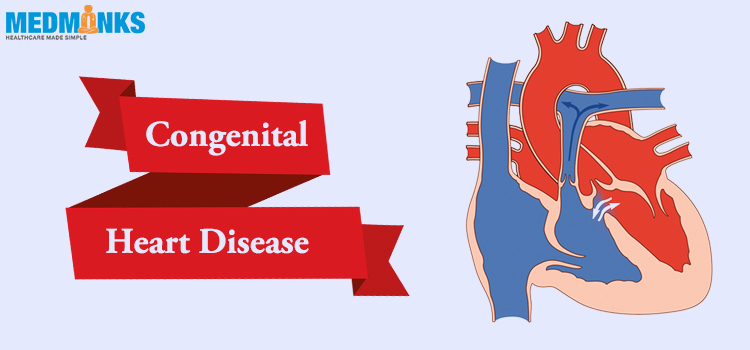 congenital-heart-disease