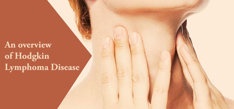hodgkin-lymphoma-disease