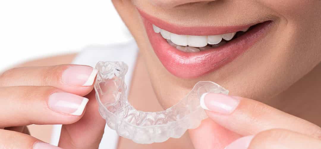 invisalign