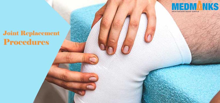joint-replacement-procedures
