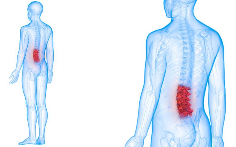 best-lumbar-spine-surgeons-delhi-ncr-india