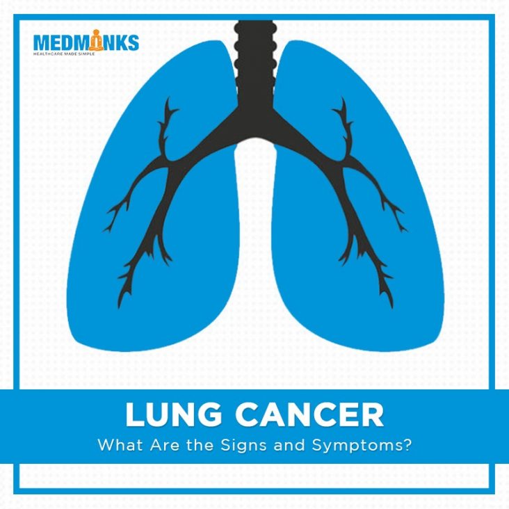 lung-cancer-what-are-the-signs-and-symptoms