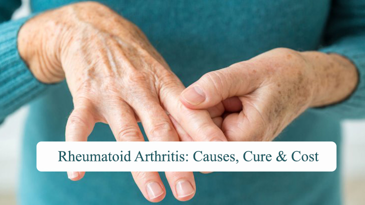 rheumatoid-arthritis