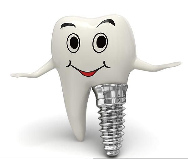 all-in-6-dental-implants