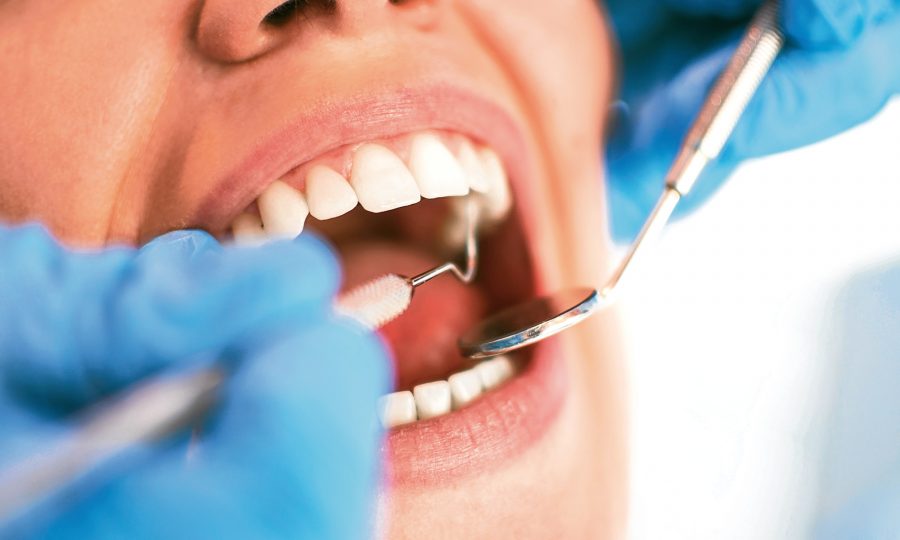 dental-crown