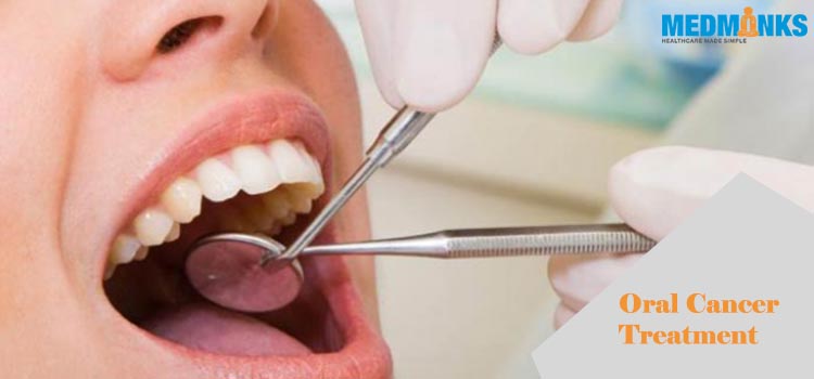oral-cancer-treatment-causes-symptoms