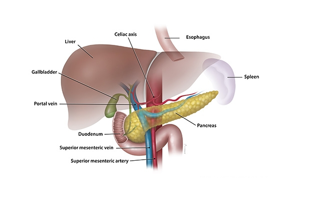 pancreas-transplant-cost-india-top-hospitals-surgeons
