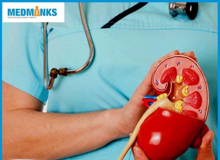 types-kidney-transplant-india